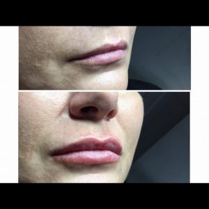 beautynaturaleaestheticsleeds - Results