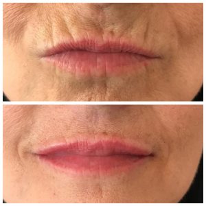 beautynaturaleaestheticsleeds - Results2