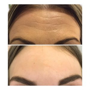 beautynaturaleaestheticsleeds - Results3