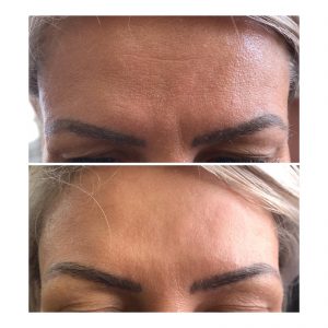 beautynaturaleaestheticsleeds - Results4